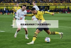 科比被烧成啥样了(科比被烧图片)